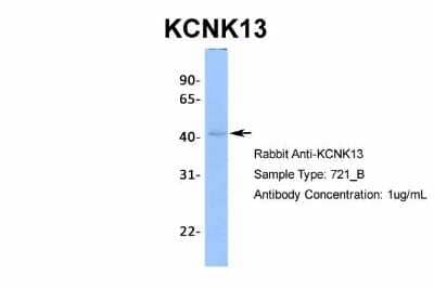 Western Blot: KCNK13 Antibody [NBP2-86690]