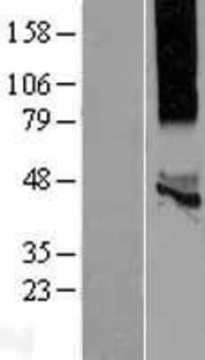 Western Blot: KCNK13 Overexpression Lysate [NBP2-06478]