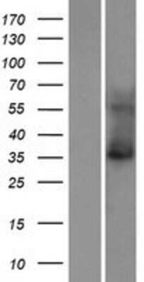 Western Blot: TASK-5/KCNK15 Overexpression Lysate [NBP2-06440]