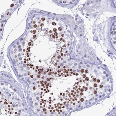 Immunohistochemistry-Paraffin: KCNK17 Antibody [NBP1-92041]