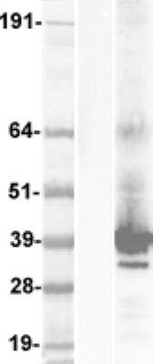 Western Blot: KCNK17 Overexpression Lysate [NBP2-06124]