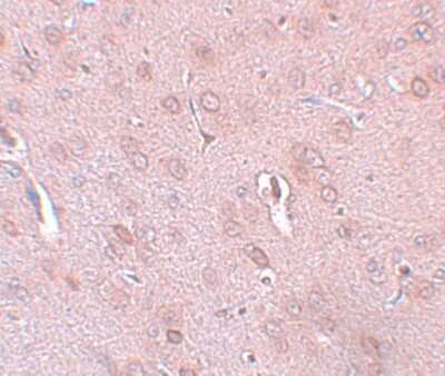Immunohistochemistry-Paraffin: KCNK18 Antibody - BSA Free [NBP1-77097]