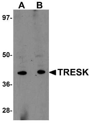 Western Blot: KCNK18 AntibodyBSA Free [NBP1-77097]