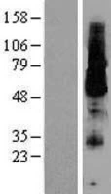 Western Blot: KCNK18 Overexpression Lysate [NBL1-12181]