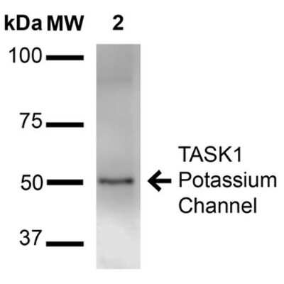 Western Blot: KCNK3 Antibody (S374-48) [NBP2-42202]