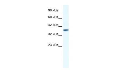 Western Blot: KCNK3 Antibody [NBP2-84108]