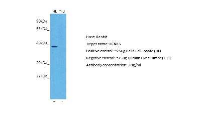 Western Blot: KCNK3 Antibody [NBP2-84108]