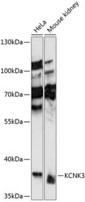 Western Blot: KCNK3 AntibodyAzide and BSA Free [NBP3-04890]