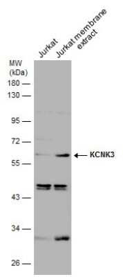Western Blot: KCNK3 Antibody [NBP3-13121]