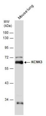 Western Blot: KCNK3 Antibody [NBP3-13121]