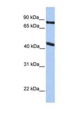 Western Blot: KCNK4 Antibody [NBP1-69621]