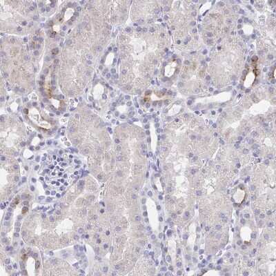 Immunohistochemistry-Paraffin: KCNK5 Antibody [NBP2-32432]