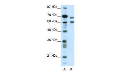 Western Blot: KCNK5 Antibody [NBP2-85135]