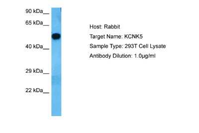 Western Blot: KCNK5 Antibody [NBP2-85136]