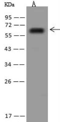 Western Blot: KCNK5 Antibody [NBP3-12615]