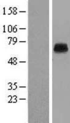 Western Blot: KCNK5 Overexpression Lysate [NBL1-12186]