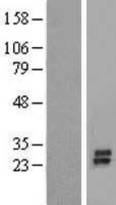 Western Blot: KCNK7 Overexpression Lysate [NBP2-05887]