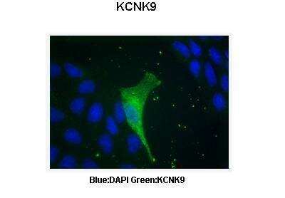 Immunohistochemistry: KCNK9 Antibody [NBP2-84109]