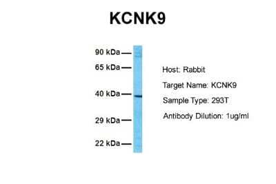 Western Blot: KCNK9 Antibody [NBP2-84109]