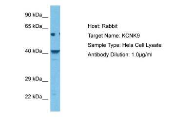 Western Blot: KCNK9 Antibody [NBP2-84109]
