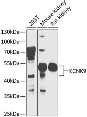 Western Blot: KCNK9 AntibodyBSA Free [NBP3-03911]