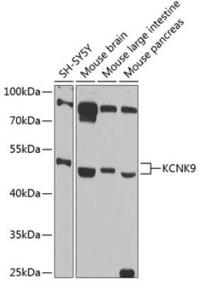 Western Blot: KCNK9 AntibodyBSA Free [NBP3-04905]