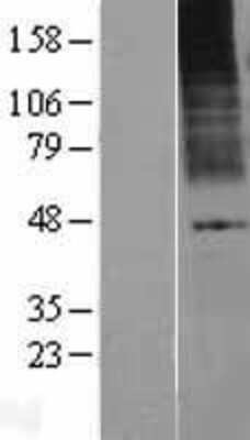 Western Blot: KCNK9 Overexpression Lysate [NBP2-04360]