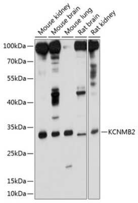 Western Blot: KCNMB2 AntibodyBSA Free [NBP3-05145]