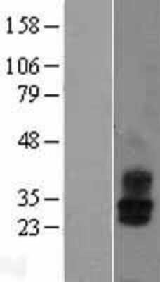 Western Blot: KCNMB2 Overexpression Lysate [NBL1-12191]