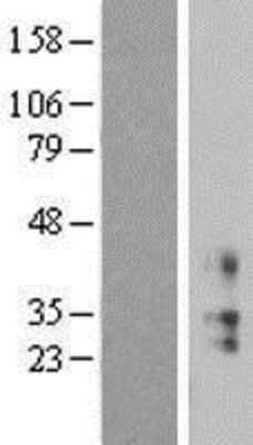 Western Blot: KCNMB2 Overexpression Lysate [NBL1-12192]