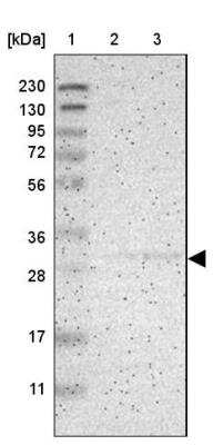 Western Blot: KCNMB3 Antibody [NBP1-83066]