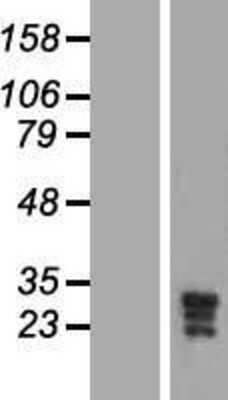 Western Blot: KCNMB3 Overexpression Lysate [NBP2-05181]