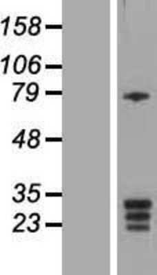 Western Blot: KCNMB3 Overexpression Lysate [NBP2-05182]