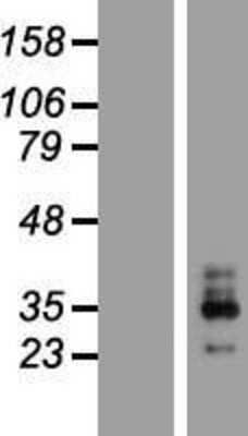 Western Blot: KCNMB3 Overexpression Lysate [NBP2-07344]