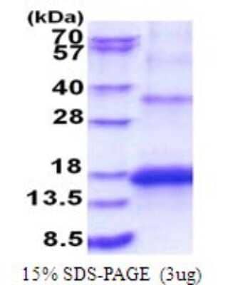 SDS-PAGE: Recombinant Human KCNMB3 His Protein [NBP2-51813]