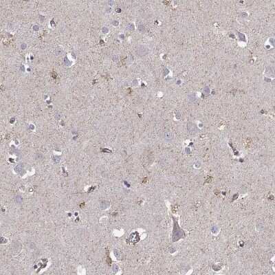 Immunohistochemistry-Paraffin: KCNMB4 Antibody [NBP2-56583]