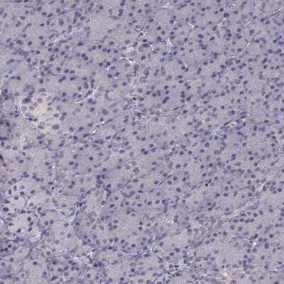 Immunohistochemistry-Paraffin: KCNMB4 Antibody [NBP2-56583]