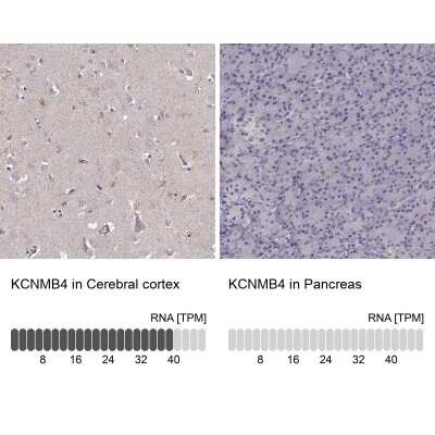 Immunohistochemistry-Paraffin: KCNMB4 Antibody [NBP2-56583]
