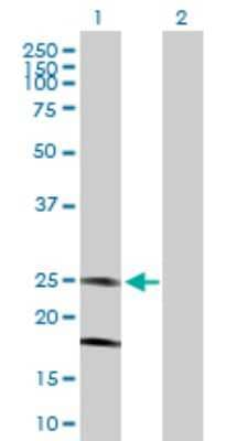 Western Blot: KCNMB4 Antibody [H00027345-B01P]