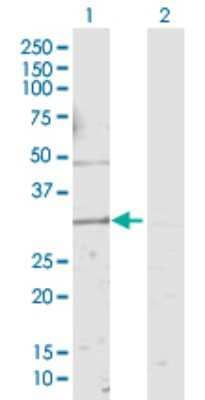 Western Blot: KCNMB4 Antibody [H00027345-D01P]