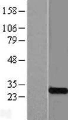 Western Blot: KCNMB4 Overexpression Lysate [NBL1-12193]