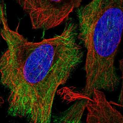 Immunocytochemistry/ Immunofluorescence: KCNN1 Antibody [NBP2-57340]