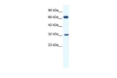 Western Blot: KCNN1 Antibody [NBP2-83105]