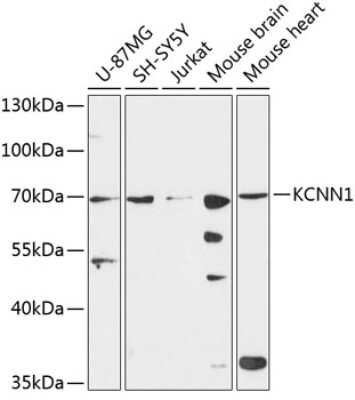 Western Blot: KCNN1 AntibodyAzide and BSA Free [NBP3-04811]