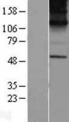 Western Blot: KCNN1 Overexpression Lysate [NBP2-04221]