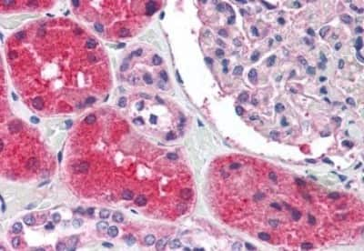 Immunohistochemistry-Paraffin: KCNN2 Antibody [NBP3-14382]