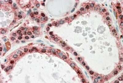 Immunohistochemistry-Paraffin: KCNN2 Antibody [NBP1-46119]