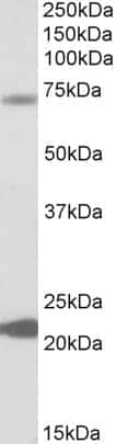 Western Blot: KCNN2 Antibody [NBP1-46119]