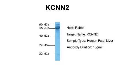 Western Blot: KCNN2 Antibody [NBP2-84111]