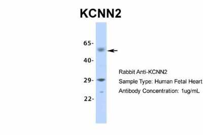 Western Blot: KCNN2 Antibody [NBP2-84112]